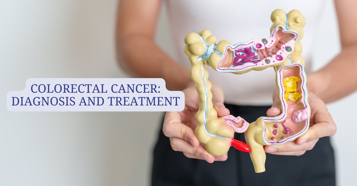 Colorectal Cancer: Diagnosis and Treatment - Pi Health Cancer Hospital