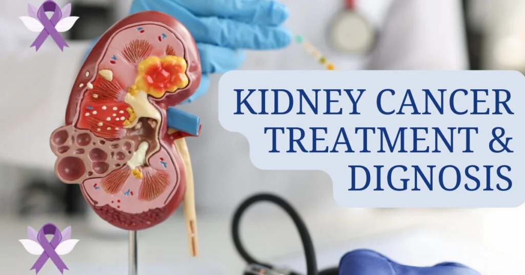 Kidney Cancer Treatment and Diagnosis