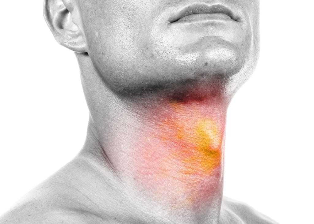 Head and neck cancer