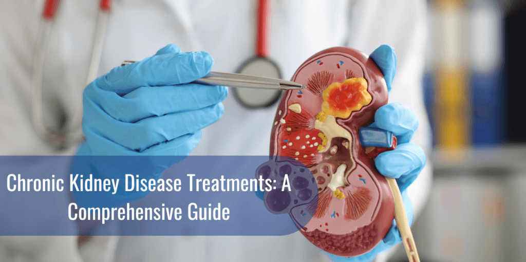 Chronic Kidney Disease Treatments: A Comprehensive Guide