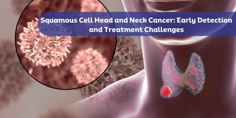 Squamous cell carcinoma Head and Neck Cancer: Early Detection and ...