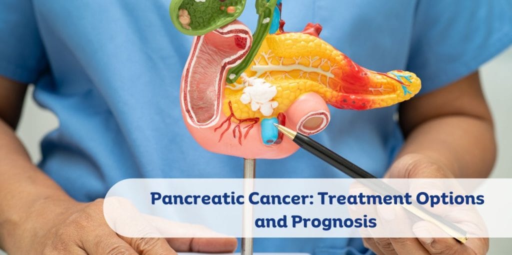 Pancreatic Cancer