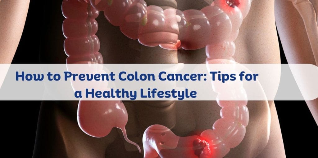 How to Prevent Colon Cancer: Tips for a Healthy Lifestyle