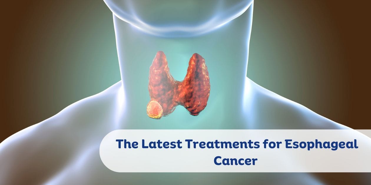 Symptoms of Thyroid Cancer