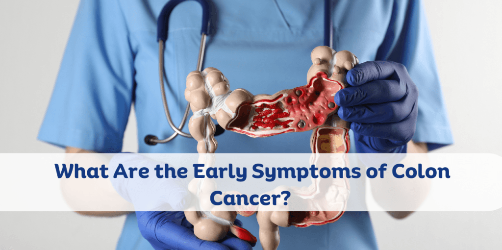 What Are the Early Symptoms of Colon Cancer
