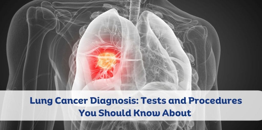 Lung Cancer Diagnosis: Tests and Procedures You Should Know About